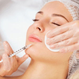 Facial Fillers